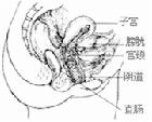 女性白带带血是怎么回事?