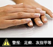 霉菌性阴道炎