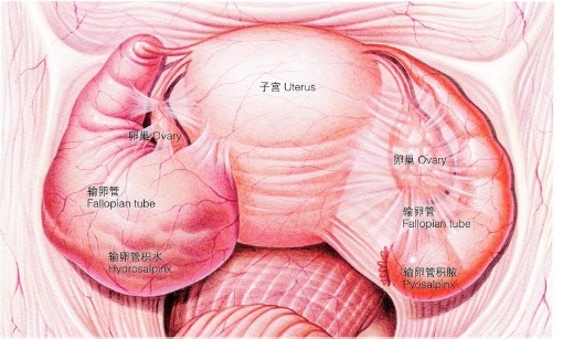 慢性附件炎有什么症状