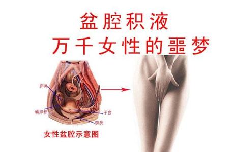 【淮安盆腔积液的费用】淮安哪家妇科医院不乱收费?