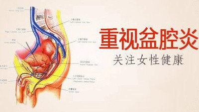 淮安盆腔炎治疗费用多少?对此你真的了解吗?