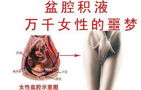 淮安盆腔积液手术费用多少?求助,谁能告诉我大概价格