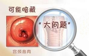 淮安宫颈息肉手术一般多少钱?不看你后悔!