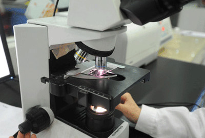 揭晓:淮安tct检查多少钱?收费标准高吗?