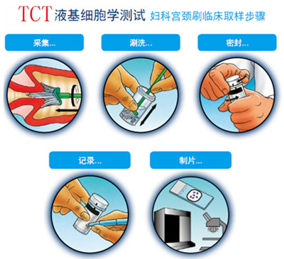 揭晓:淮安tct检查多少钱?收费标准高吗?