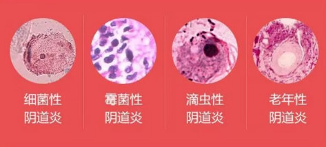 你好,我这几天下身有点瘙痒流暗红色的液体,这为什么?