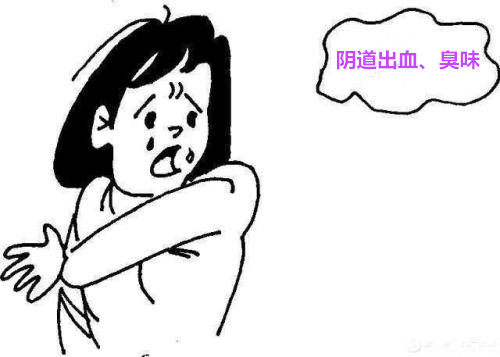 本人26岁,长期下体出血有臭味,可能是这3个原因导致