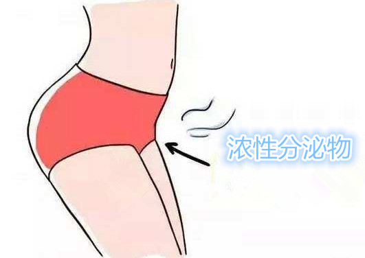 阴道浓性分泌物,不痒也无味,怎么办?