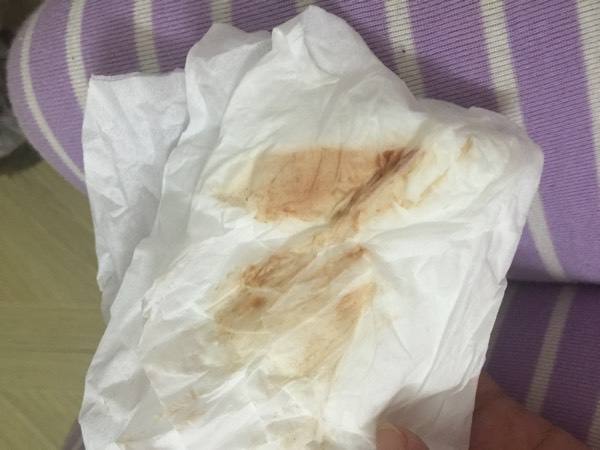 为什么每次做爱后有褐色的液体流出,量不多?