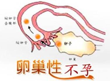 想治疗排卵障碍有相关的食谱吗