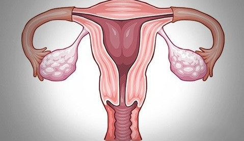 淮安看盆腔炎要多少钱?【提问】盆腔炎能自愈吗?