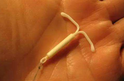 淮安上环多少钱?【节育环价格】这几种节育环有什么不同?
